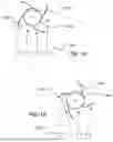 Fig. 12 - CONFIGURABLE MULTI-PURPOSE CROSS-FLOW WIND TURBINE WITH PERFORMANCE ENHANCEMENTS