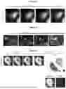 Fig. 16 - METHOD AND DEVICE FOR ULTRA-RAPID CRYO-FIXATION OF A SAMPLE FOR MICROSCOPIC STUDIES