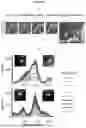Fig. 17 - METHOD AND DEVICE FOR ULTRA-RAPID CRYO-FIXATION OF A SAMPLE FOR MICROSCOPIC STUDIES
