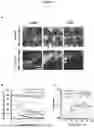 Fig. 18 - METHOD AND DEVICE FOR ULTRA-RAPID CRYO-FIXATION OF A SAMPLE FOR MICROSCOPIC STUDIES