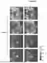Fig. 21 - METHOD AND DEVICE FOR ULTRA-RAPID CRYO-FIXATION OF A SAMPLE FOR MICROSCOPIC STUDIES