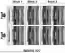 Fig. 69 - Magnetic Resonance Spectroscopy Frequency and Phase Correction