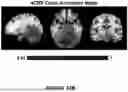 Fig. 72 - Magnetic Resonance Spectroscopy Frequency and Phase Correction