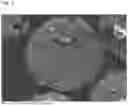 Fig. 02 - CARRIER CORE MATERIAL AND ELECTROPHOTOGRAPHIC DEVELOPMENT CARRIER USING SAME AND ELECTROPHOTOGRAPHIC DEVELOPER