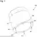 Fig. 06 - RESILIENT CASING RING FOR CASING A HOROLOGICAL MOVEMENT AND WATCH CASE COMPRISING SUCH A RESILIENT CASING RING