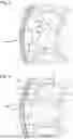 Fig. 03 - DEVICE FOR MAINTAINING OR LIMITING THE SHAKE OF A TIMEPIECE COMPONENT