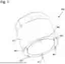 Fig. 06 - SMART WATCH COMPRISING A COMMON-GROUND DEVICE FOR A HOROLOGICAL MOVEMENT