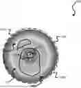 Fig. 01 - Calcium Arc Computation Relative to Lumen Center