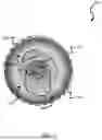Fig. 02 - Calcium Arc Computation Relative to Lumen Center