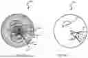 Fig. 06 - Calcium Arc Computation Relative to Lumen Center