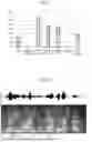 Fig. 02 - DYSARTHRIA DETECTION METHOD, DYSARTHRIA DETECTION DEVICE, AND RECORDING MEDIUM