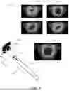 Fig. 04 - ULTRASONIC IMAGING SYSTEM, AND NON-TRANSITORY COMPUTER-READABLE MEDIUM