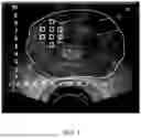 Fig. 06 - ULTRASONIC IMAGING SYSTEM, AND NON-TRANSITORY COMPUTER-READABLE MEDIUM