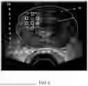 Fig. 07 - ULTRASONIC IMAGING SYSTEM, AND NON-TRANSITORY COMPUTER-READABLE MEDIUM