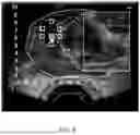 Fig. 09 - ULTRASONIC IMAGING SYSTEM, AND NON-TRANSITORY COMPUTER-READABLE MEDIUM
