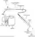 Fig. 01 - Intravascular lithotripsy