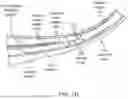 Fig. 04 - Intravascular lithotripsy