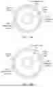 Fig. 09 - Intravascular lithotripsy