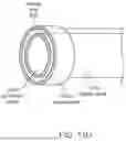 Fig. 20 - Intravascular lithotripsy