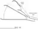 Fig. 22 - Intravascular lithotripsy