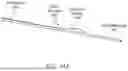 Fig. 23 - Intravascular lithotripsy