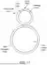 Fig. 28 - Intravascular lithotripsy