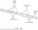 Fig. 30 - Intravascular lithotripsy