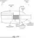 Fig. 40 - Intravascular lithotripsy