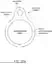 Fig. 45 - Intravascular lithotripsy