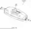 Fig. 55 - Intravascular lithotripsy