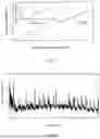 Fig. 04 - A MINIMALLY SWELLABLE BIOCOMPATIBLE MEMBRANE AND PREPARATION METHOD THEREOF