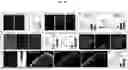 Fig. 35 - COMPOSITIONS AND METHODS FOR TARGETING INFLAMMATORY OR ACTIVATED CELLS AND TREATING OR AMELIORATING INFLAMMATORY CONDITIONS AND PAIN
