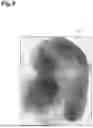 Fig. 10 - RADIOGRAPHIC IMAGE ACQUIRING DEVICE, RADIOGRAPHIC IMAGE ACQUIRING SYSTEM, AND RADIOGRAPHIC IMAGE ACQUISITION METHOD