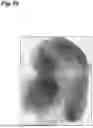 Fig. 40 - RADIOGRAPHIC IMAGE ACQUIRING DEVICE, RADIOGRAPHIC IMAGE ACQUIRING SYSTEM, AND RADIOGRAPHIC IMAGE ACQUISITION METHOD