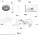 Fig. 02 - SYSTEM AND METHOD FOR NMR ANALYSIS OF A PHYSIOLOGICAL CONDITION IN AN ANALYTE
