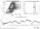 Fig. 43 - HIGH PARAMETER FLOW CYTOMETRIC ASSAY TO IDENTIFY HUMAN MYELOID DERIVED SUPPRESSIVE CELLS