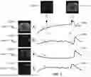 Fig. 02 - SYSTEMS AND METHODS OF ON-THE-FLY GENERATION OF 3D DYNAMIC IMAGES USING A PRE-LEARNED SPATIAL SUBSPACE