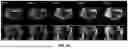 Fig. 07 - SYSTEMS AND METHODS OF ON-THE-FLY GENERATION OF 3D DYNAMIC IMAGES USING A PRE-LEARNED SPATIAL SUBSPACE