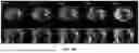 Fig. 08 - SYSTEMS AND METHODS OF ON-THE-FLY GENERATION OF 3D DYNAMIC IMAGES USING A PRE-LEARNED SPATIAL SUBSPACE