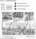 Fig. 03 - MULTIPURPOSE VISUAL & AUDITORY INTELLIGENT OBSERVER SYSTEM
