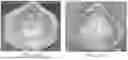 Fig. 20 - SYSTEMS AND METHODS FOR IMPROVED RESPIRATORY PROTECTION DEVICES