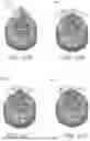 Fig. 22 - SYSTEMS AND METHODS FOR IMPROVED RESPIRATORY PROTECTION DEVICES
