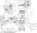 Fig. 01 - Catheter with Distal Tilt Detection