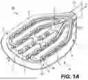 Fig. 02 - CATHETER WITH FLEXIBLE POLYMER AS OUTER SUPPORT STRUCTURE