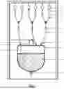 Fig. 02 - ENDOSCOPIC SURGERY IRRIGATION DEVICE ALLOWING A CONTINUOUS FEED