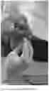Fig. 02 - METHOD FOR CORRECTING COMMON FOOT DISORDERS ASSOCIATED WITH DIABETES