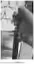 Fig. 06 - METHOD FOR CORRECTING COMMON FOOT DISORDERS ASSOCIATED WITH DIABETES