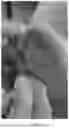 Fig. 07 - METHOD FOR CORRECTING COMMON FOOT DISORDERS ASSOCIATED WITH DIABETES