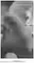 Fig. 08 - METHOD FOR CORRECTING COMMON FOOT DISORDERS ASSOCIATED WITH DIABETES