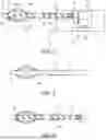 Fig. 02 - A THROMBECTOMY DEVICE